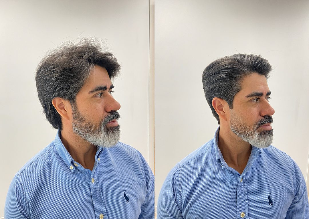 Antes e depois: corte com visagismo, cliente 1