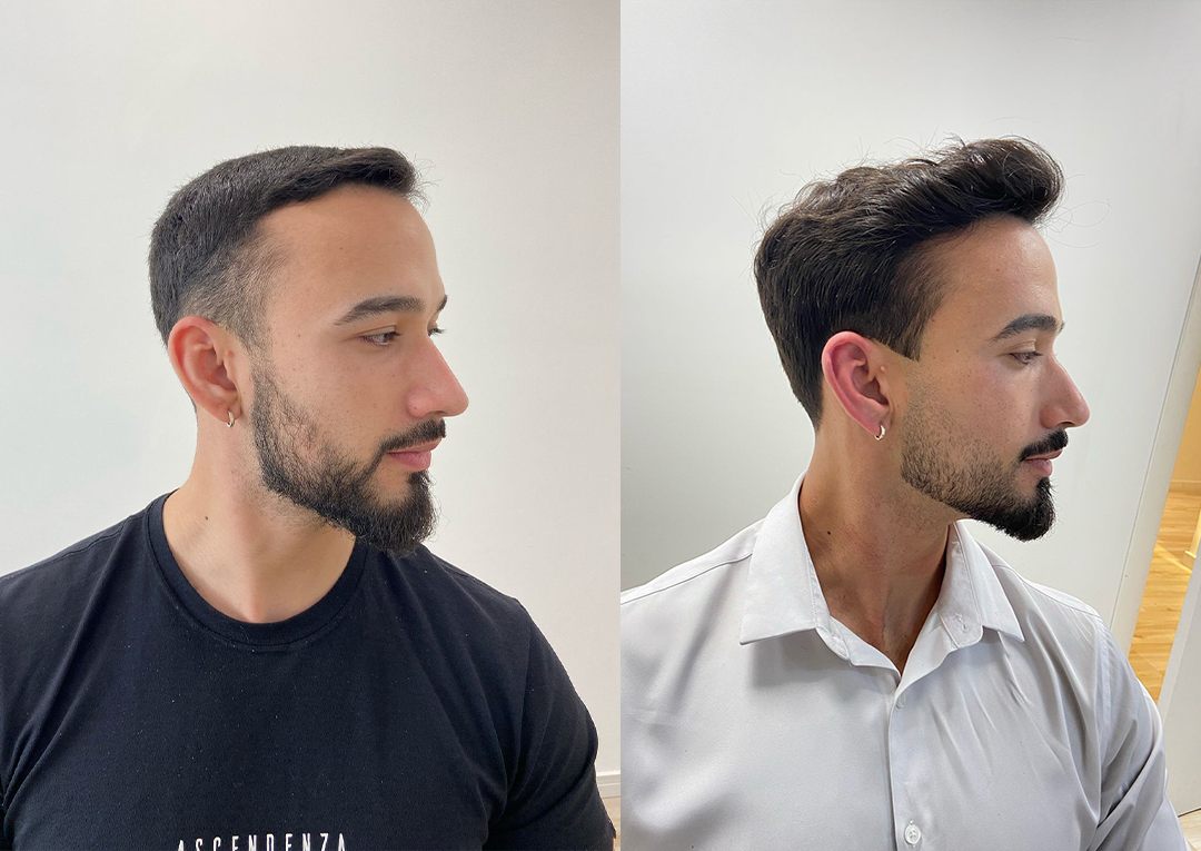 Antes e depois: corte com visagismo, cliente 3