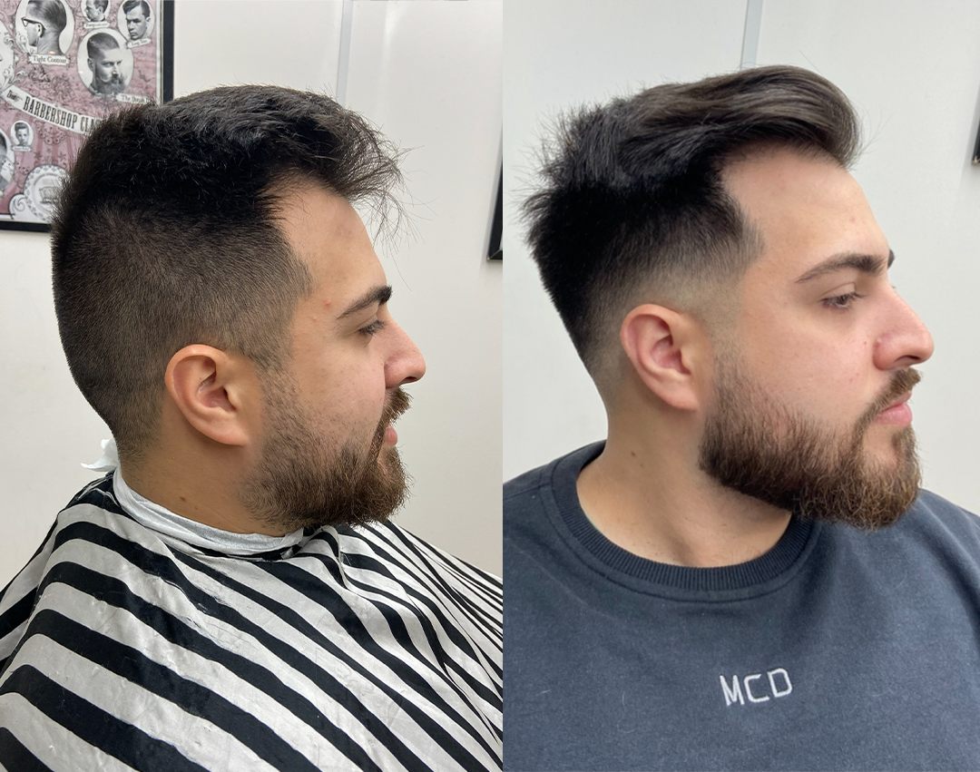 Antes e depois: corte com visagismo, cliente 5